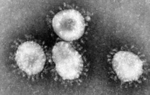 Coronavirus Suspension Activités